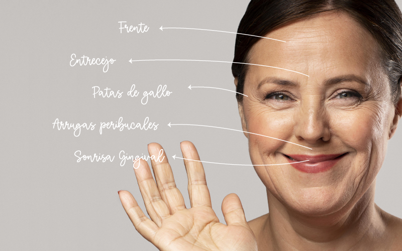 Aplicacion de Toxina Botulinica